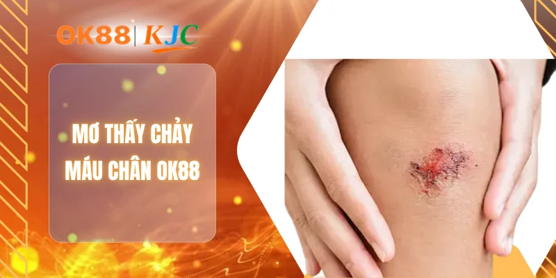 MƠ THẤY CHẢY MÁU CHÂN OK88